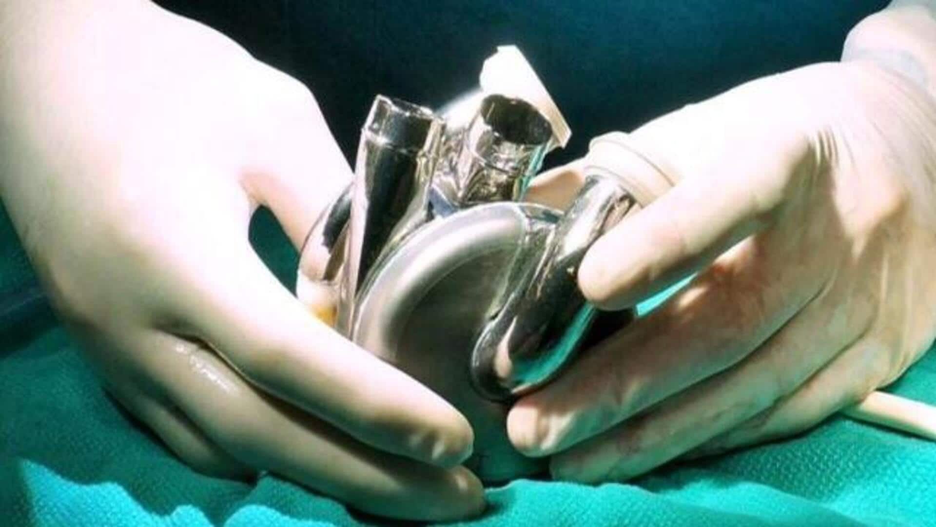 Man survives for 8 days with a titanium heart implant