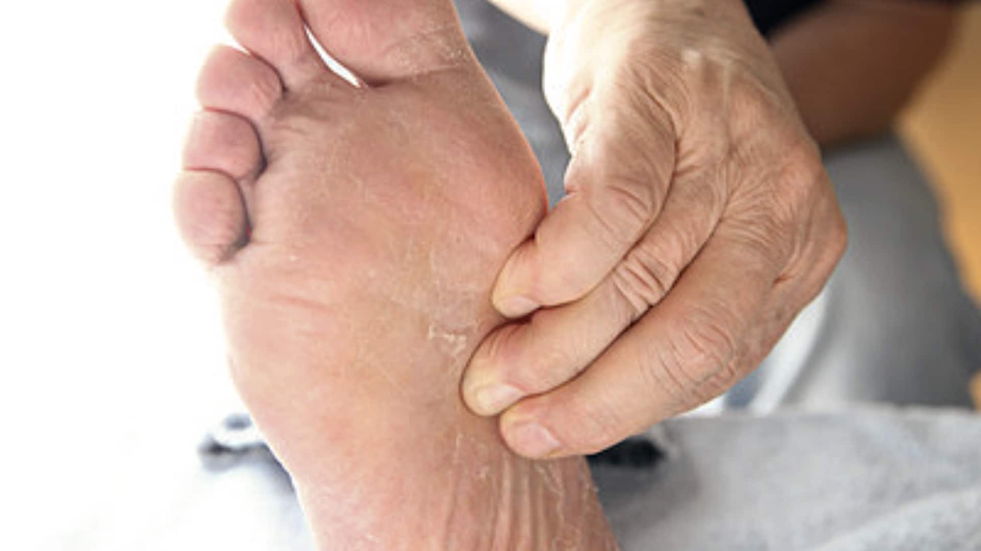 Fix foot arch pain with these exercises