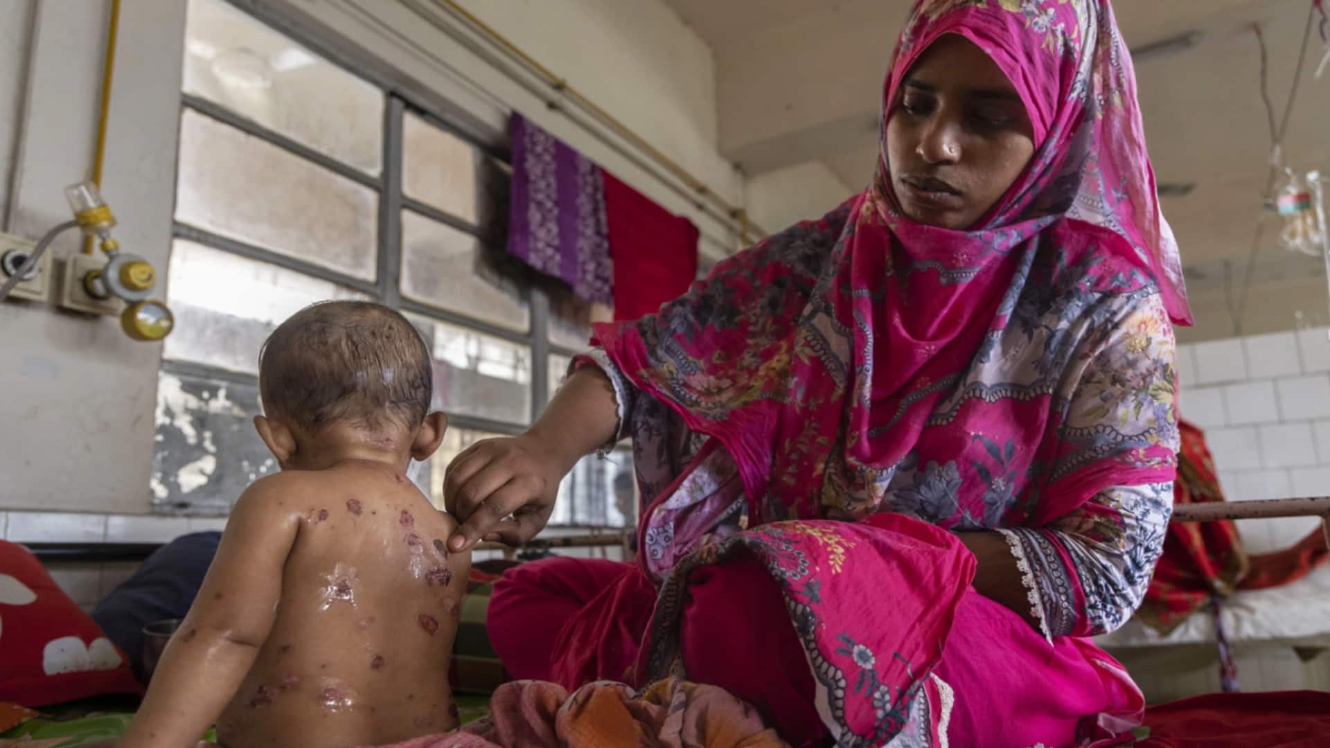 Measles outbreak in Bangladesh: 130 children dead, emergency vaccination launched