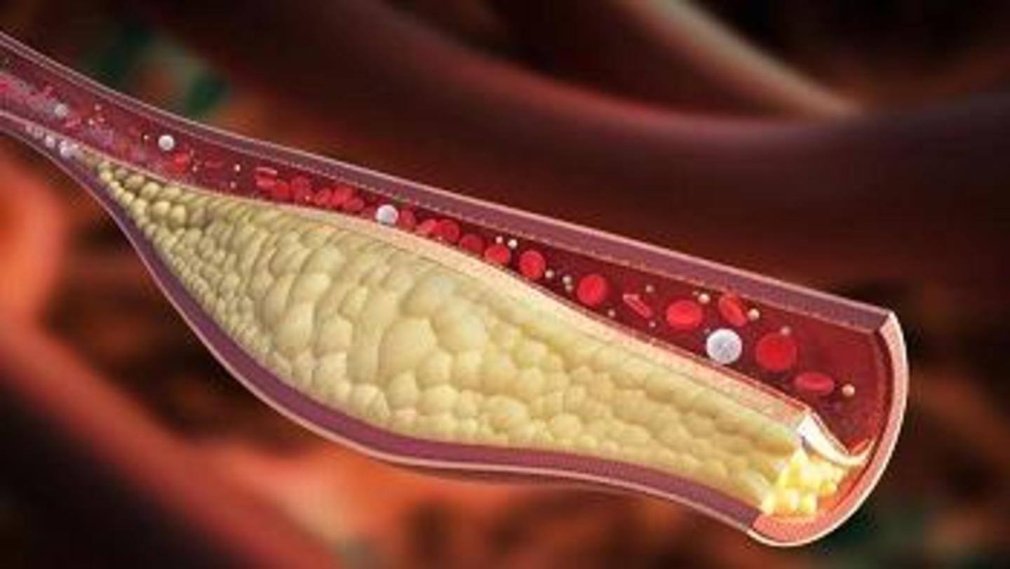 Helps in lowering cholesterol levels Helps in lowering cholesterol levels