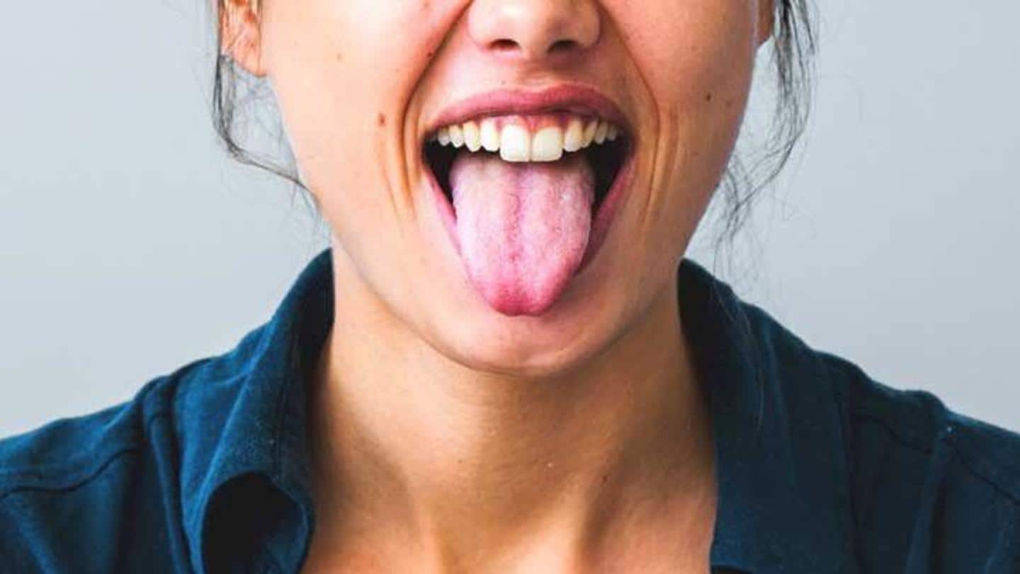 Have a white tongue? Know its causes, remedies and prevention