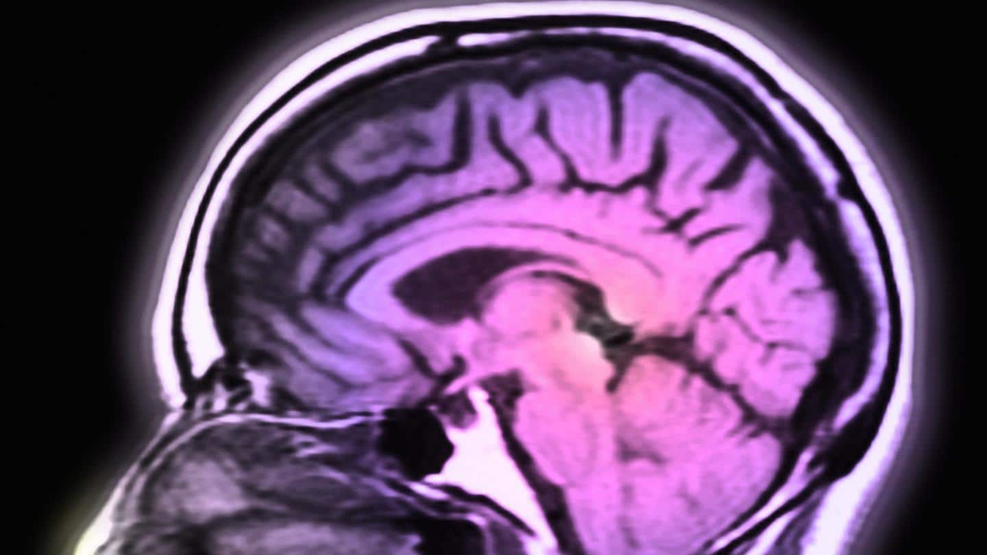 Could COVID-19 alone lead to reduction in gray matter? Could COVID-19 alone lead to reduction in gray matter?