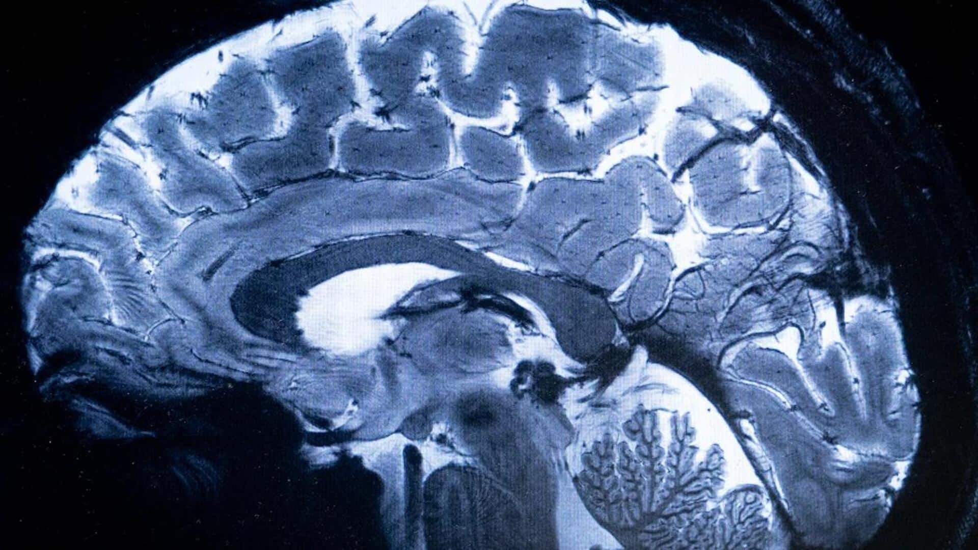 Groundbreaking MRI scanner captures first images of human brain