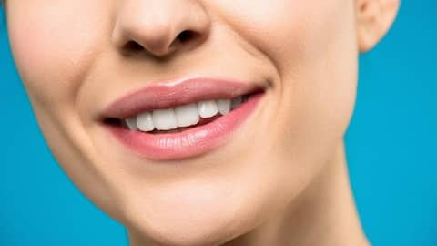 What are teeth whiteners? Should you get one