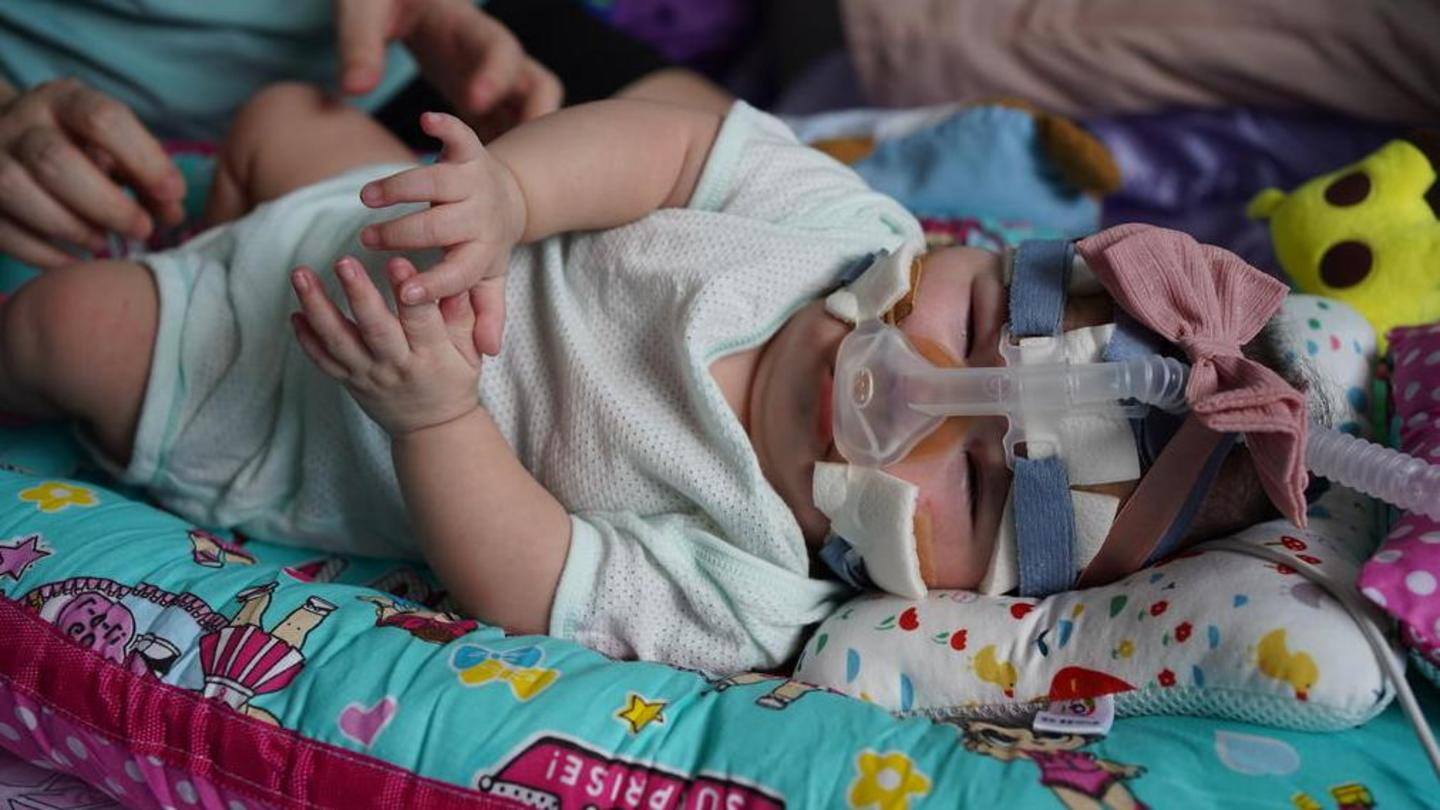 'Never saw such a small baby,' nurse says 'Never saw such a small baby,' nurse says