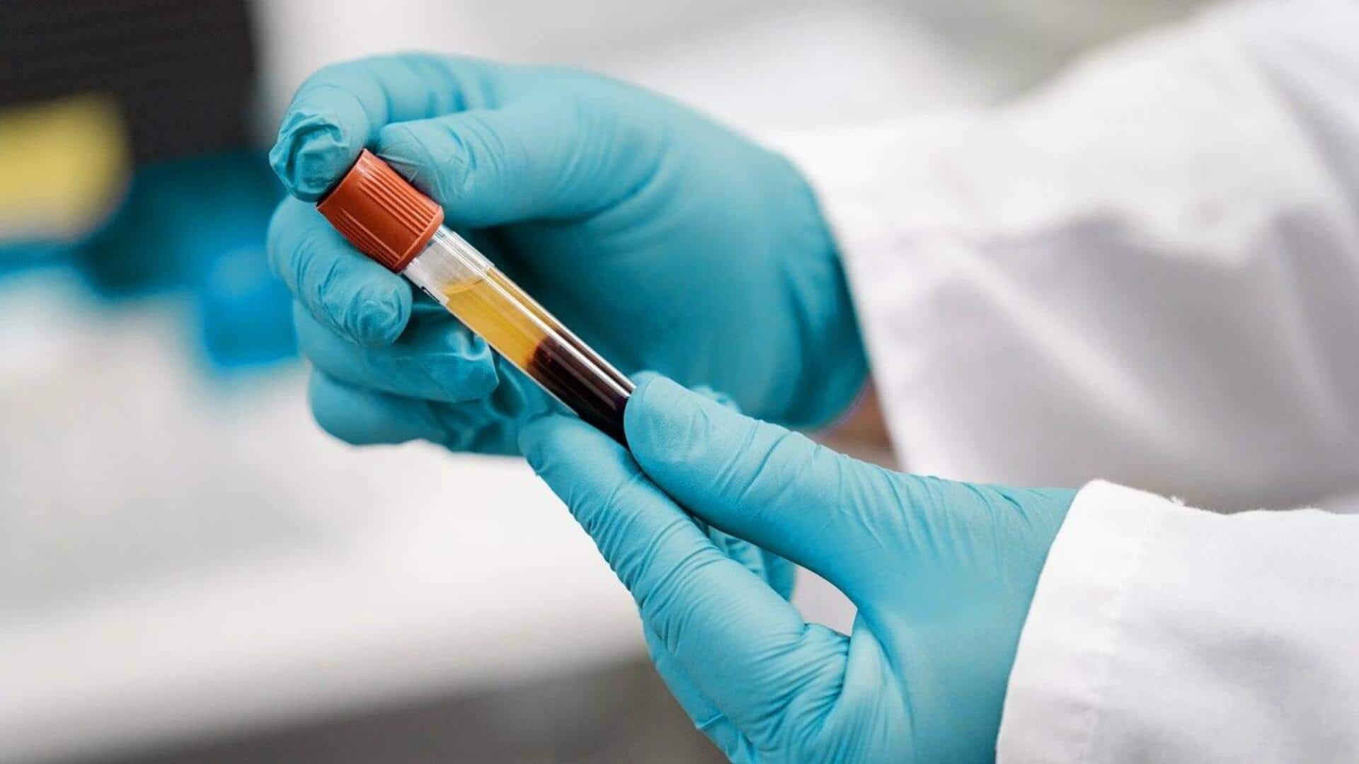 We finally have a blood test to diagnose chronic-fatigue syndrome