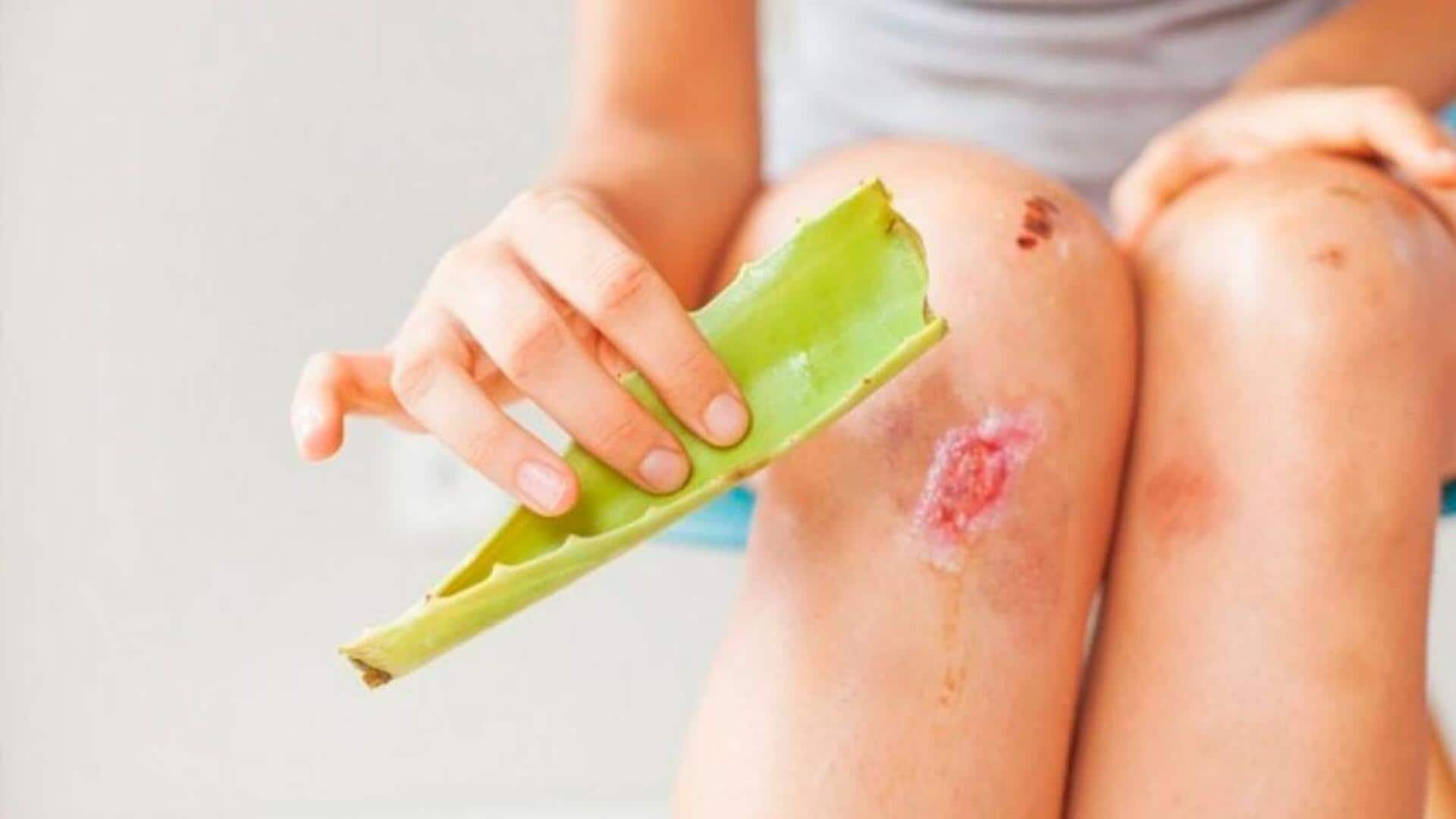 Aloe vera gel can heal minor skin cuts