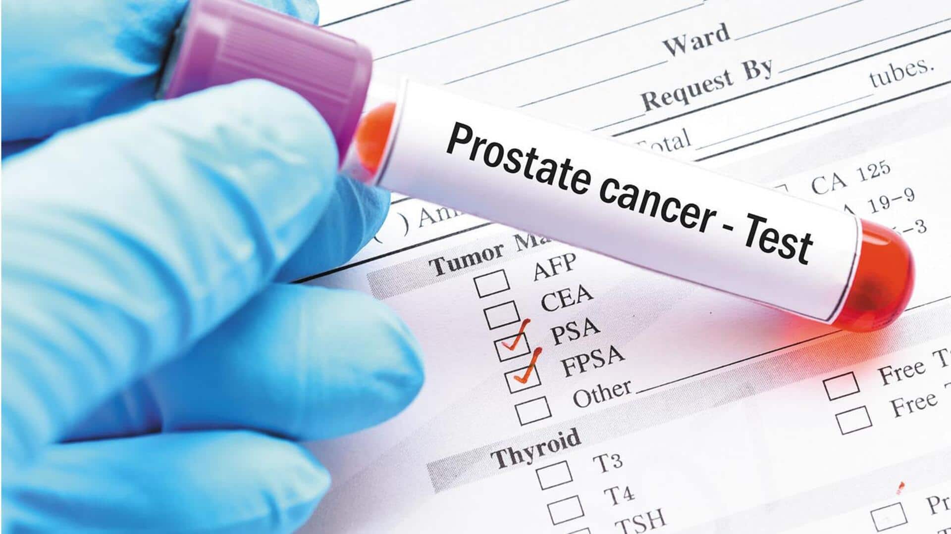 Do all men have to undergo a prostate cancer test?