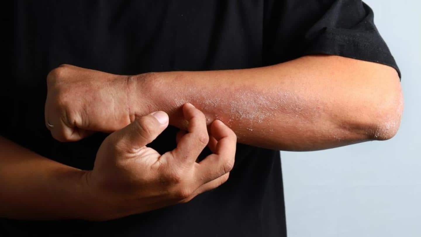 Protects against various bacterial and fungal infections Protects against various bacterial and fungal infections