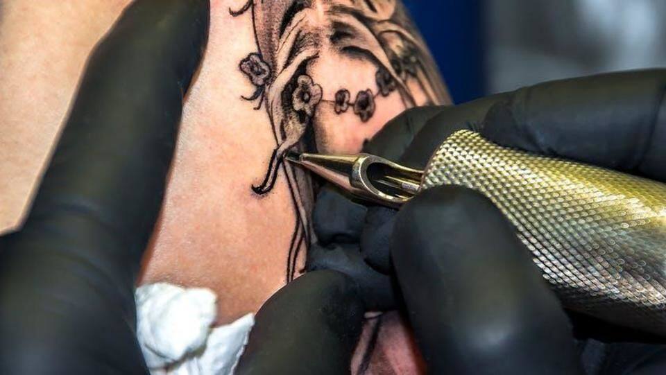 Laser Tattoo Removal Surgery CostÂ in Delhi, India