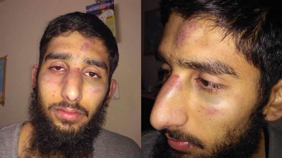J&K CM demands probe after assault on Kashmiri students