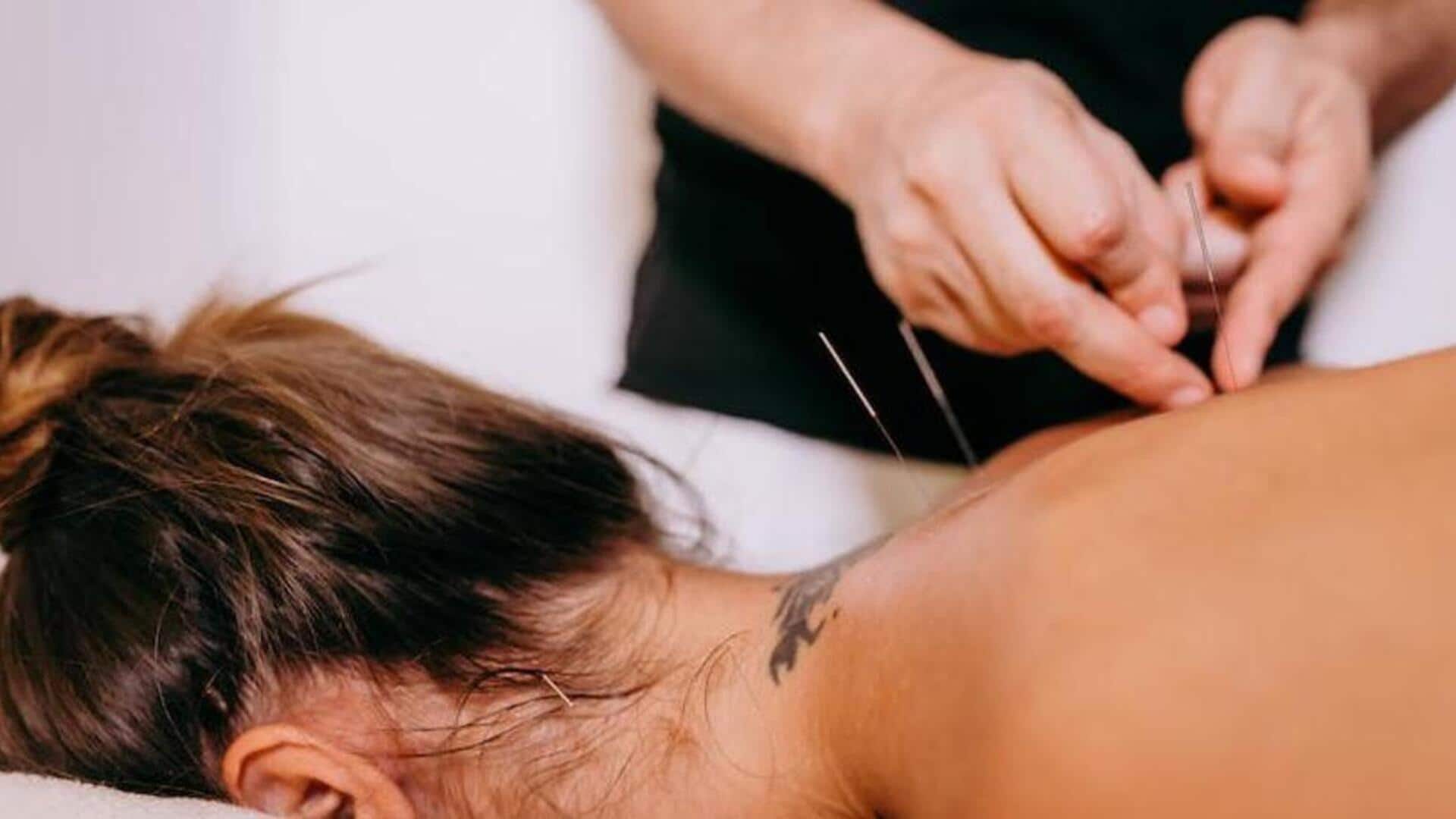 Jarum-jarum penyembuh: Mengungkap proses akupunktur