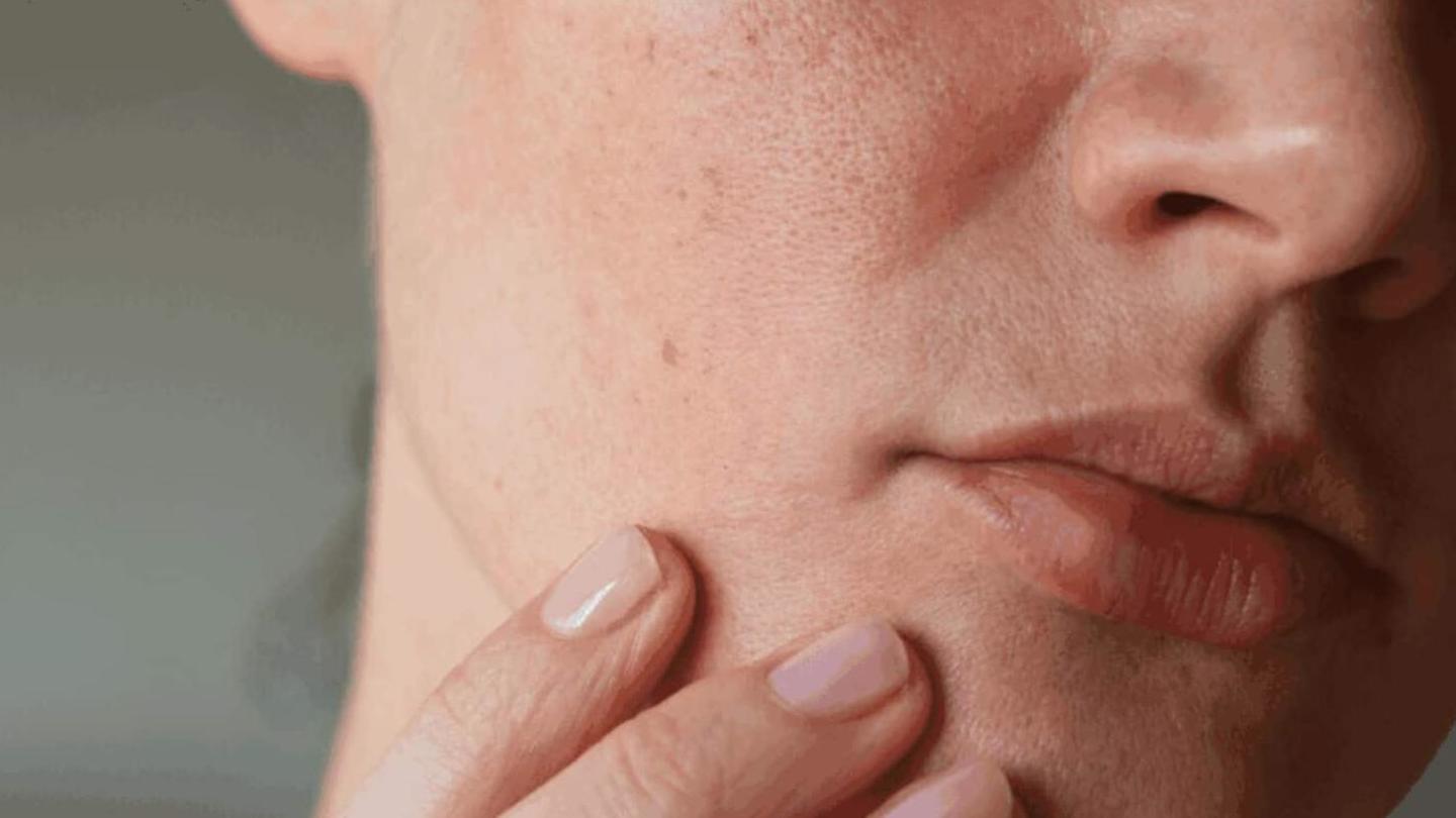 Perawatan kulit: Tips untuk merawat kulit sensitif