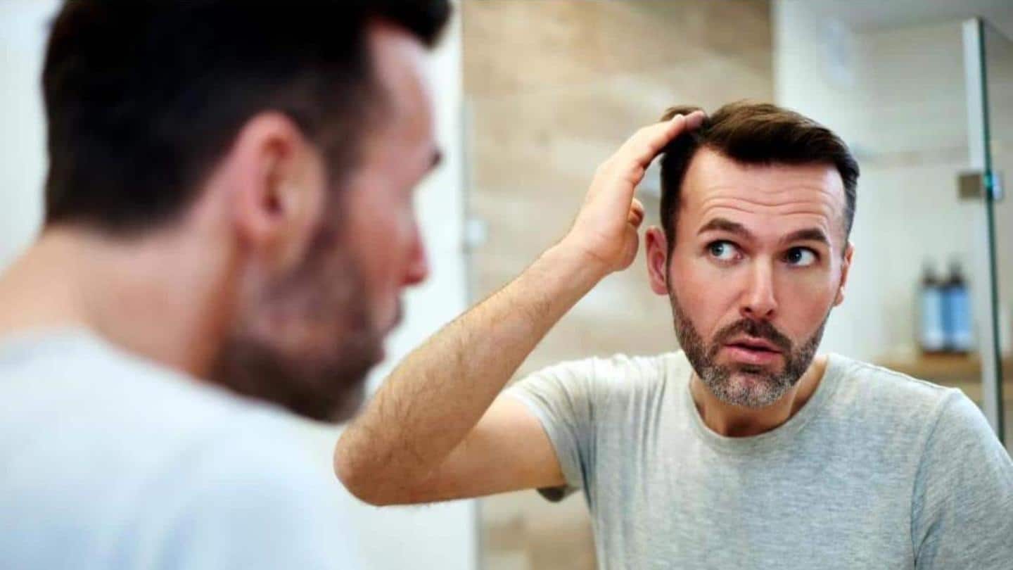 Mengalami kebotakan? Solusi efektif untuk mengurangi rambut rontok pada pria
