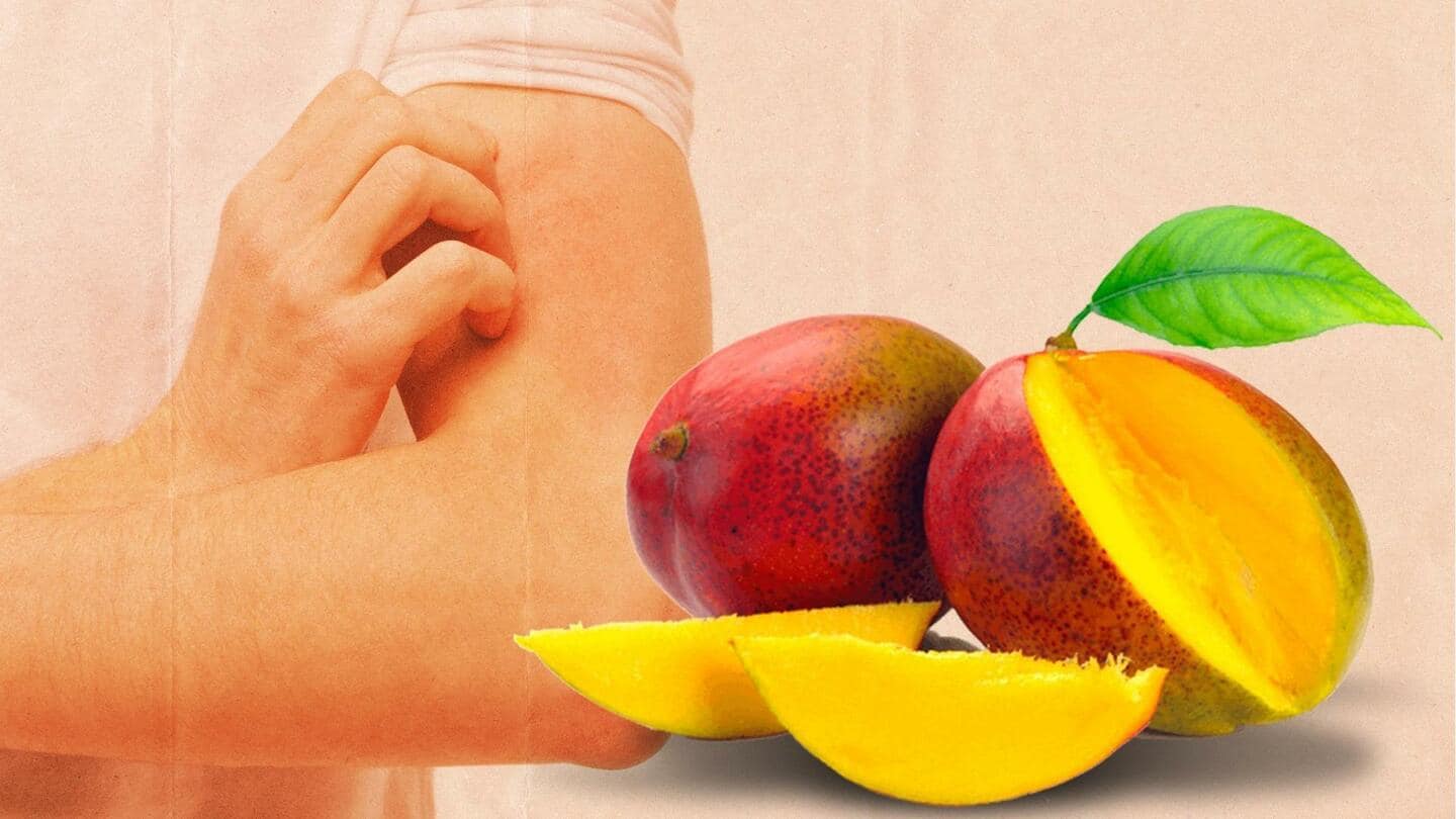 Alergi dengan mangga? Tenang, Anda tidak sendirian