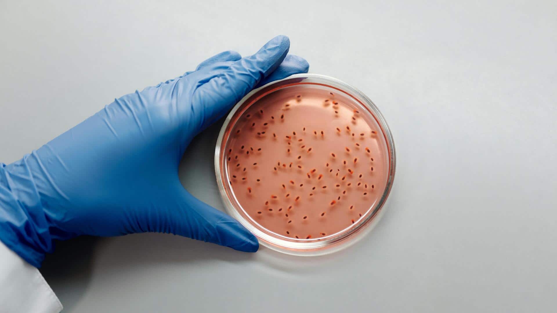 Mikroorganisme yang Membersihkan Tumpahan Minyak di Seluruh Dunia