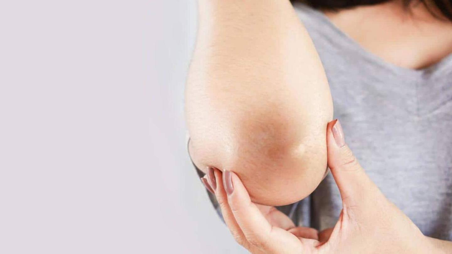 Solusi efektif untuk mencerahkan kulit gelap pada siku dan lutut