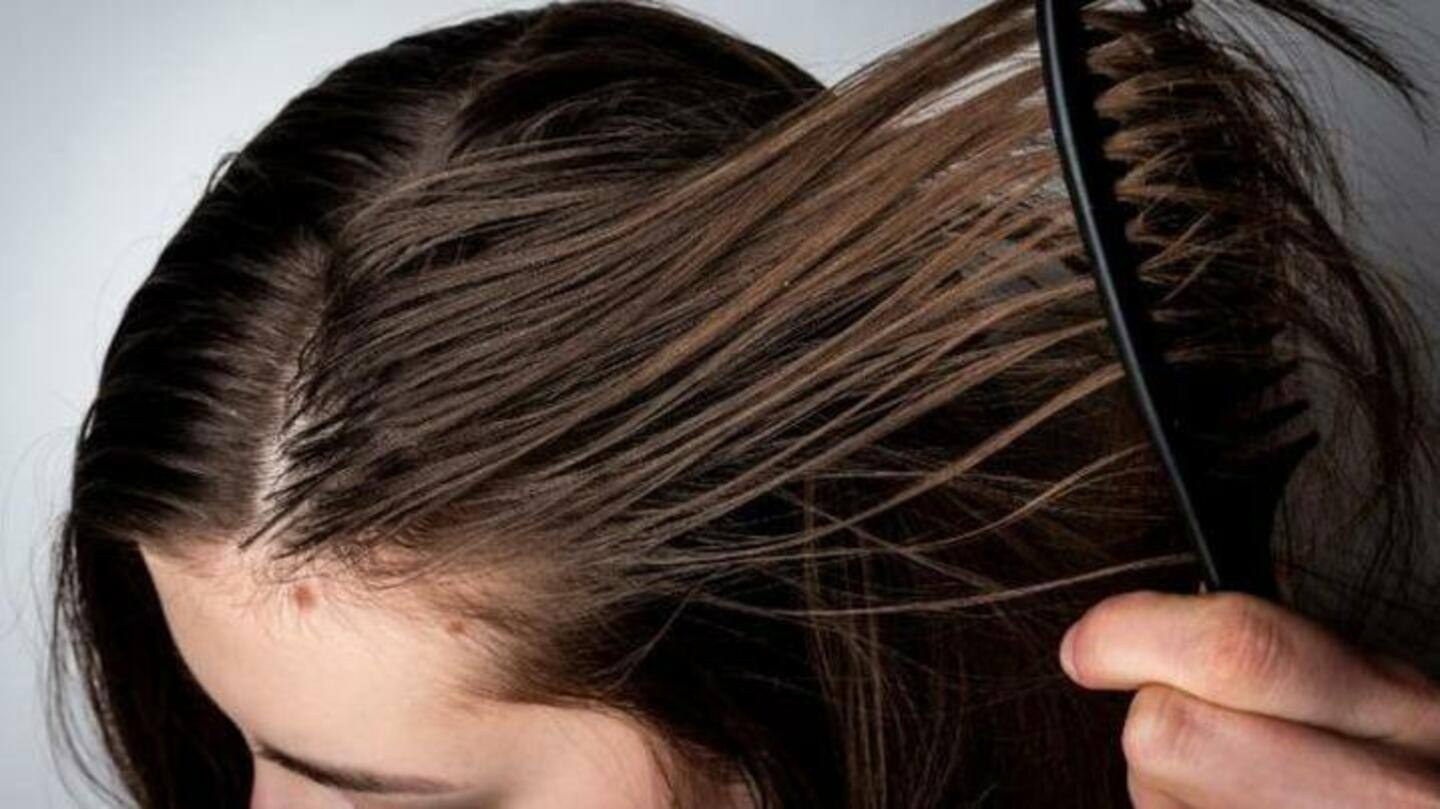 Tips untuk membantu Anda menyingkirkan masalah rambut berminyak