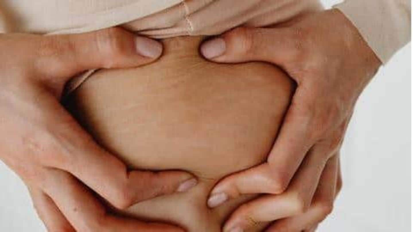 5 cara rumahan menghilangkan stretch mark