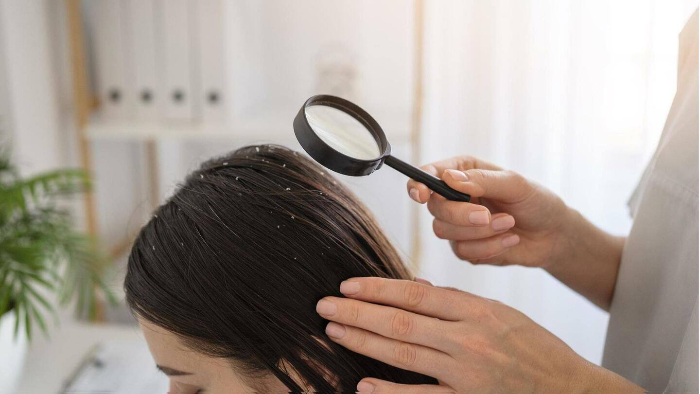 Mengalami kutu rambut? Hilangkan kutu rambut dengan cara-cara mudah ini