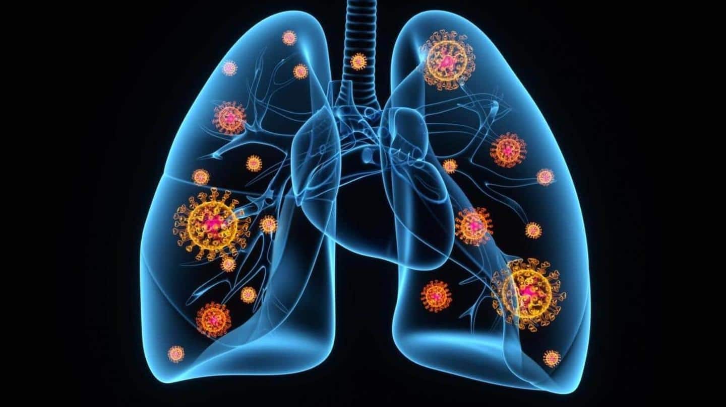 #HealthBytes: Ketahui mengapa pneumonia COVID-19 berbeda dan mematikan