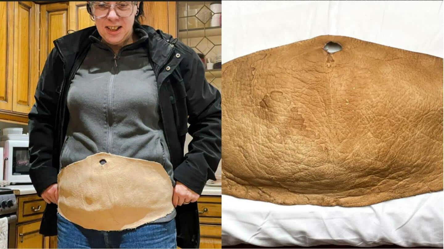 Wanita ini mengubah kulit perutnya sendiri menjadi kulit bebas kekejaman