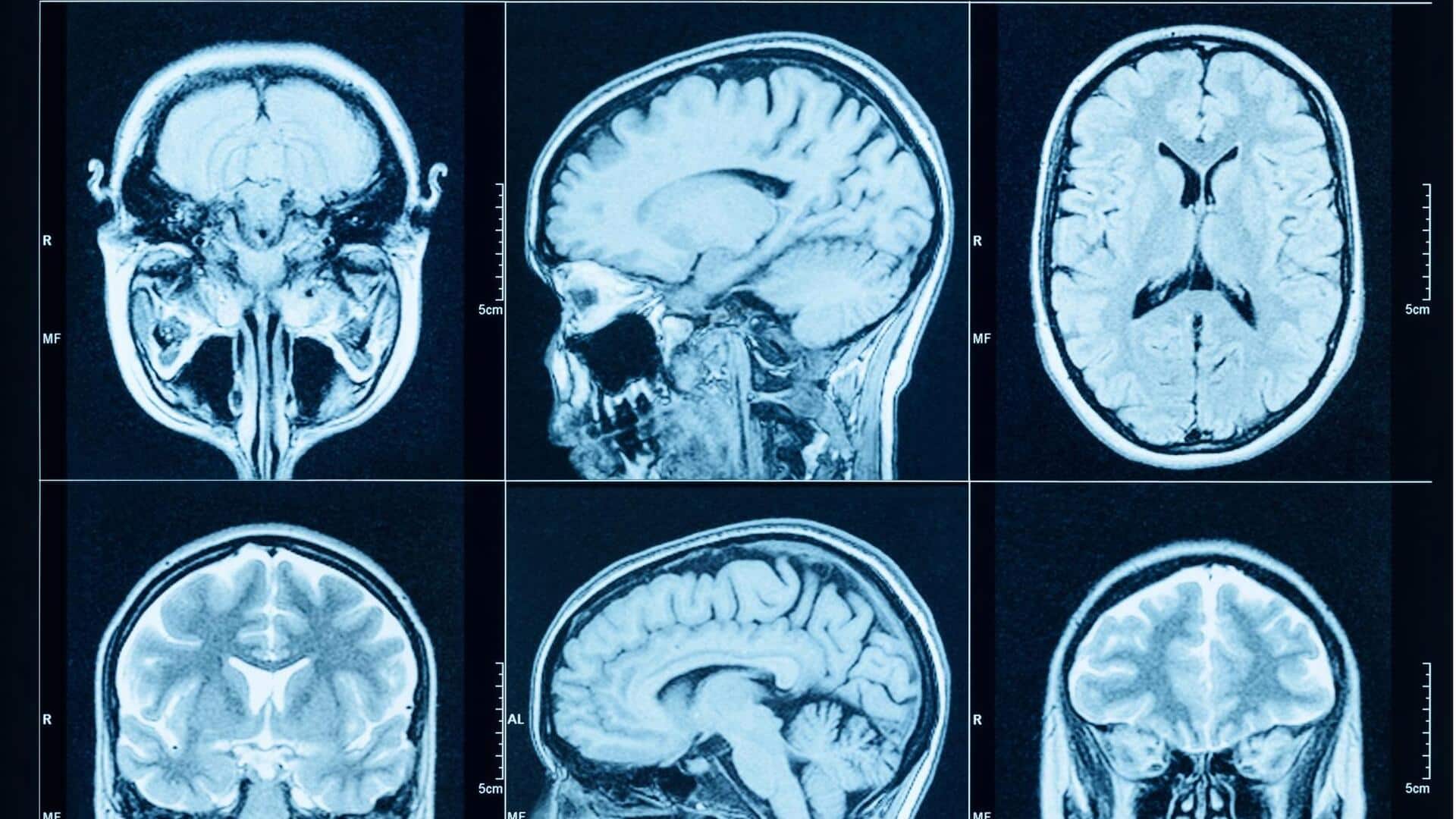 Lima Penggunaan Cerdas dari Gelombang Radio dalam Sains Modern