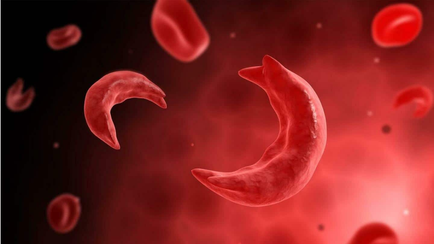 Target bebas tahun 2047, ini serba-serbi anemia sel sabit yang landa India