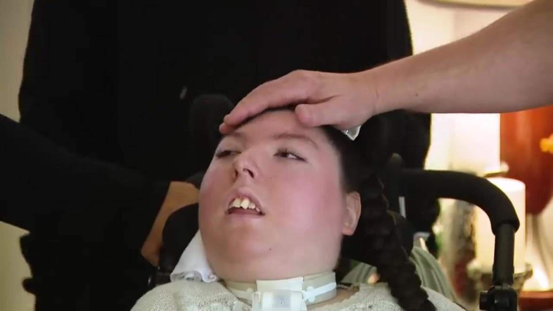 மருத்துவ அதிசயம்: மூளையே இல்லாமல் பிறந்த பெண் 20வது பிறந்தநாள் கொண்டாட்டம்