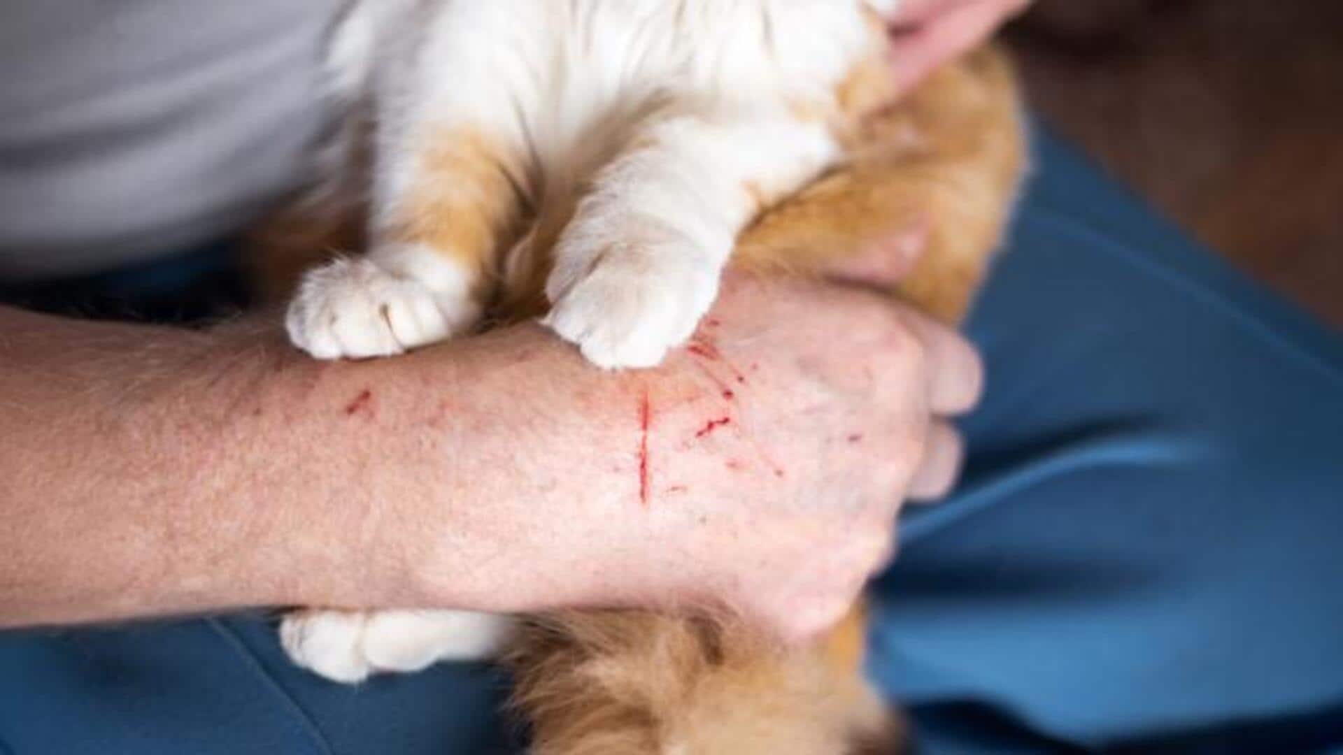 நாய், பூனை கீறினாலும் ரேபிஸ் பரவுமா? அலெர்ட் மக்களே; மருத்துவர்கள் எச்சரிக்கை