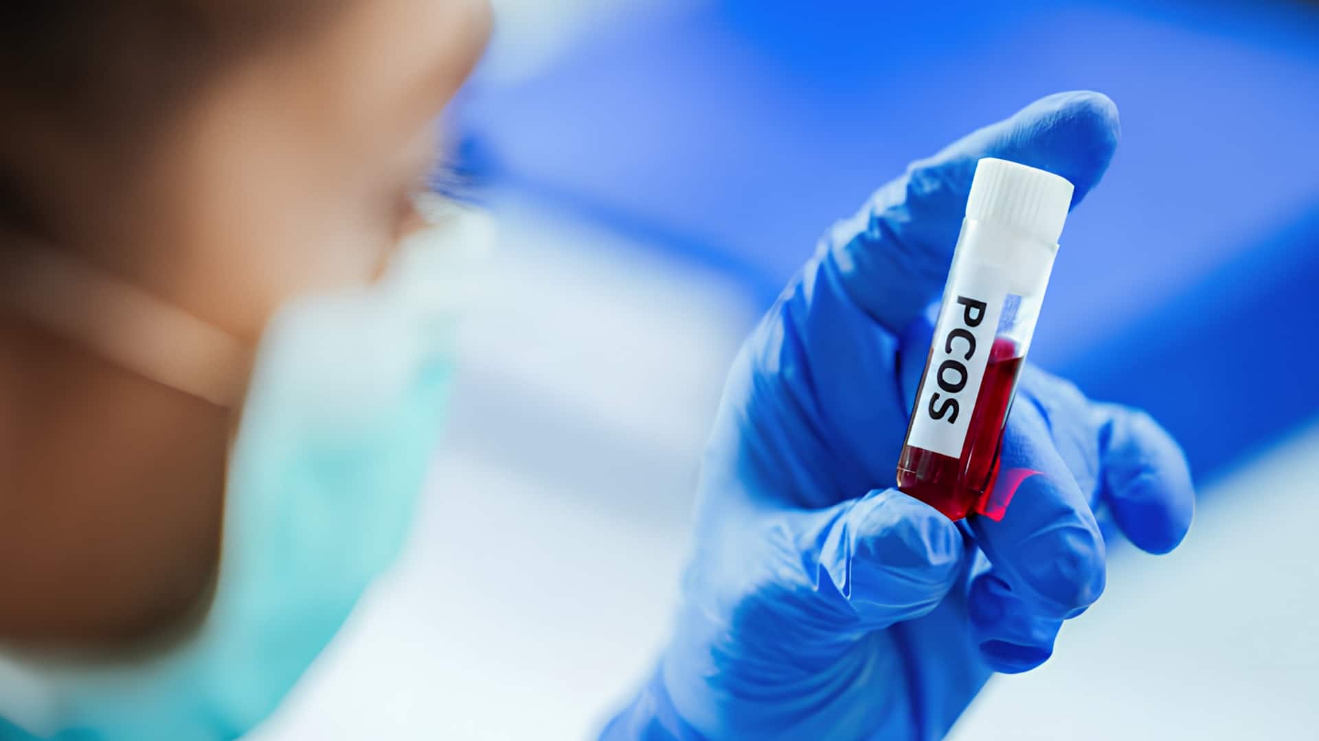 ஒல்லியா இருந்தாலும் PCOS வரலாம்! 3-5% இளம் பெண்களுக்கு பாதிப்பு; எய்ம்ஸ் ஆய்வு அதிர்ச்சி தகவல்