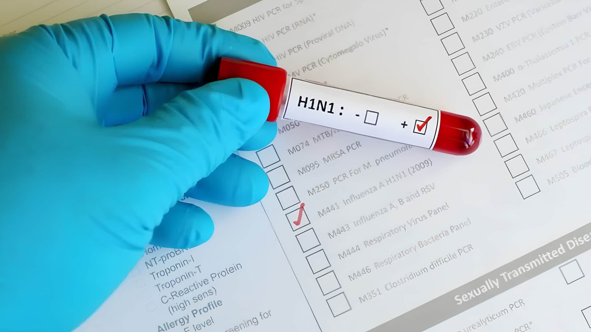 75% இன்ஃபுளூயன்ஸா மாதிரிகளில் H1N1 வைரஸ்! தமிழகம், கேரளாவில் டெங்கு பாதிப்பு உச்சம்! மருத்துவர்கள் எச்சரிக்கை