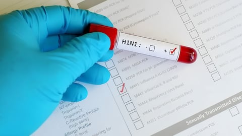 75% இன்ஃபுளூயன்ஸா மாதிரிகளில் H1N1 வைரஸ்! தமிழகம், கேரளாவில் டெங்கு பாதிப்பு உச்சம்! மருத்துவர்கள் எச்சரிக்கை