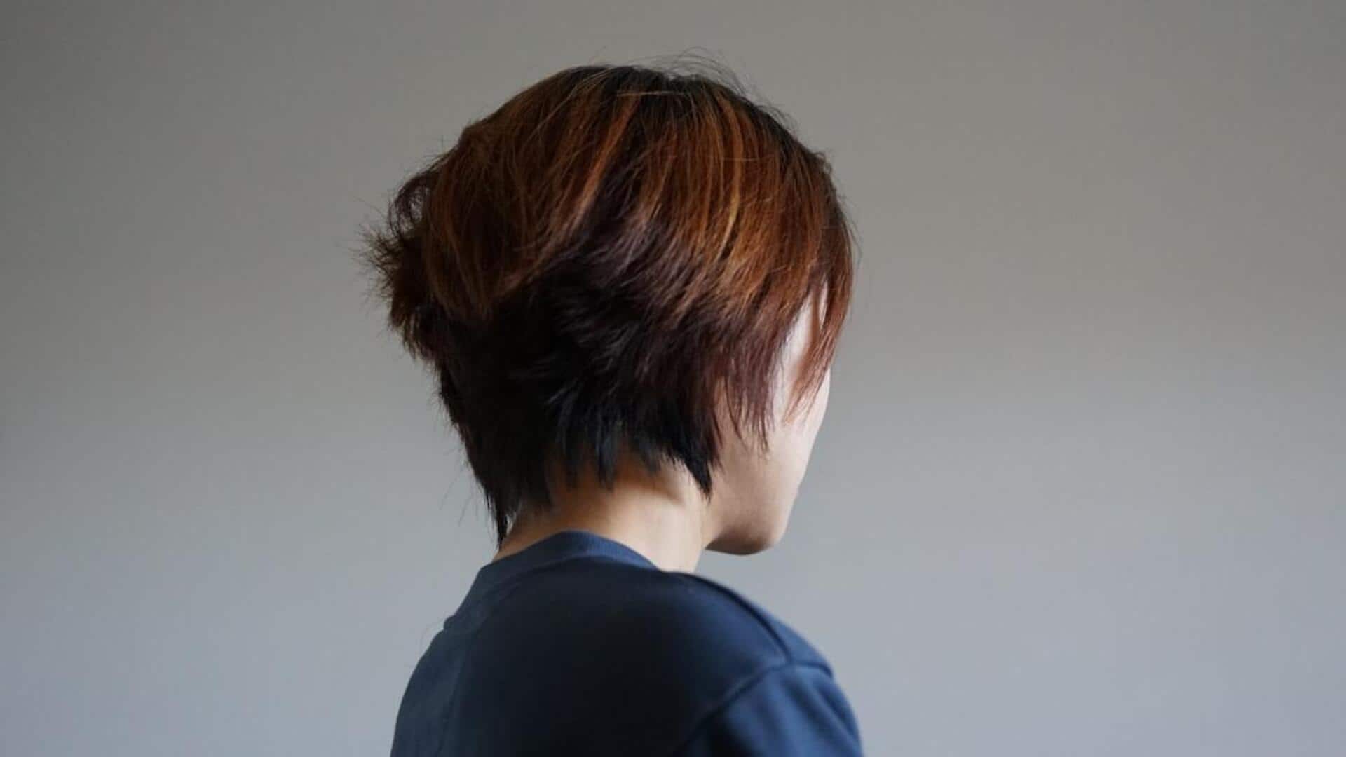 முடி மாற்று அறுவை சிகிச்சை வலிக்குமா? வழுக்கையை போக்க நினைப்பவர்கள் கவனிக்க வேண்டிய முக்கிய உண்மைகள்