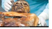 Mummy: 5,300 ఏళ్ల ఓట్జీ మమ్మీలో ఇంకా సజీవంగా ఉన్న సూక్ష్మజీవులు.. శాస్త్రవేత్తల సంచలన ఆవిష్కరణ