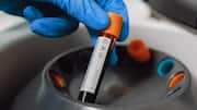 Forever Chemicals: షాకింగ్.. మనుషుల రక్తంలో 98.8% వరకు 'ఫరెవర్ కెమికల్స్' గుర్తింపు
