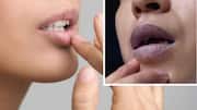 Skin Care Tips: పెదవులు పొడిబారడం తీవ్రమైన సమస్య కావచ్చు.. కారణాలు తెలుసుకోండిలా..