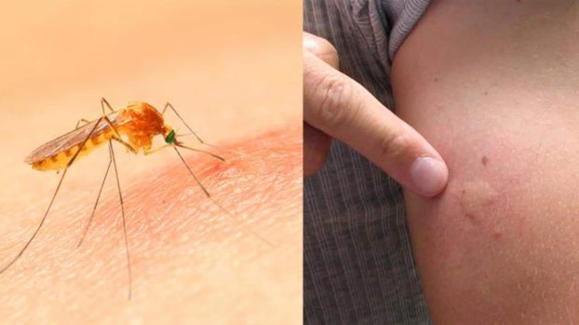 Health Tips: కీటకాల కాటు వల్ల దురద సమస్యలు .. తగ్గించుకోవడానికి చేయండిలా..