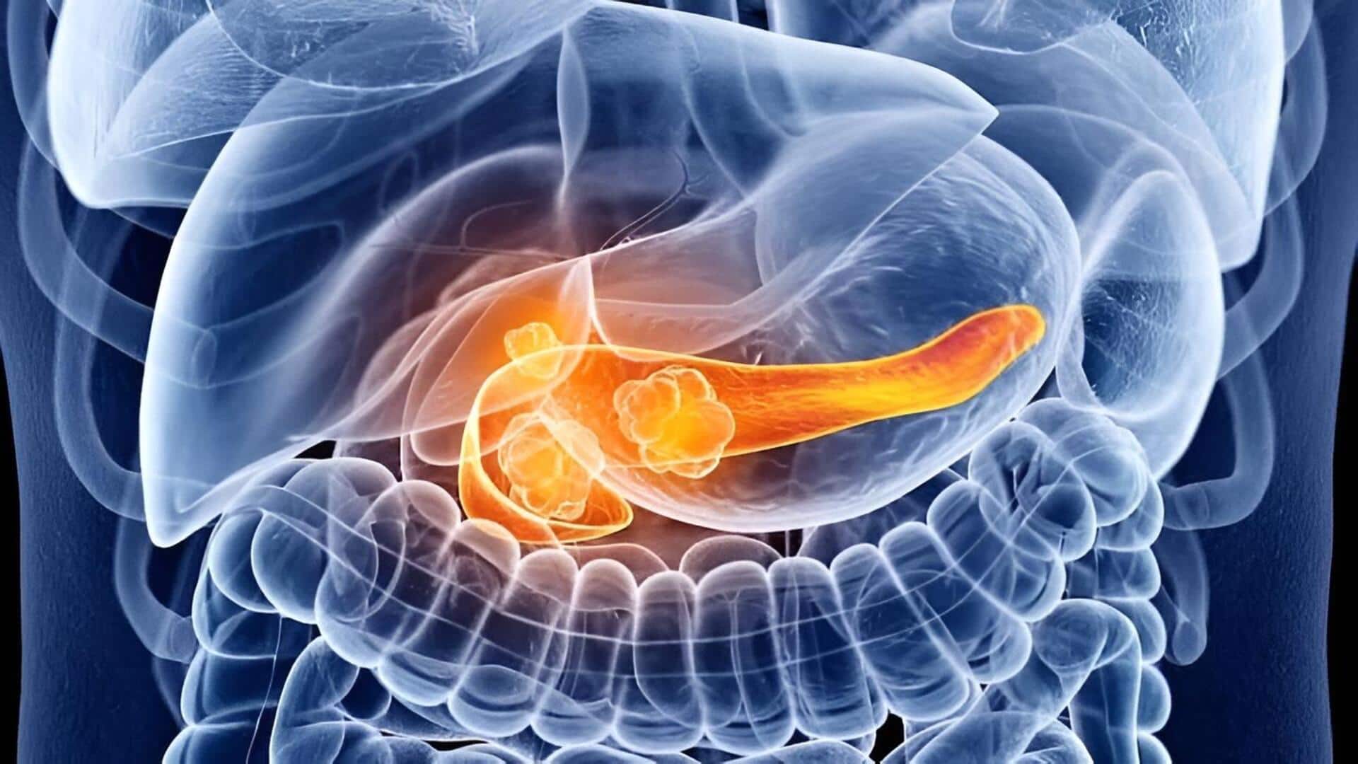 Pancreatic Cancer: ప్యాంక్రియాటిక్ క్యాన్సర్ రోగులకు ఆశాకిరణం.. జీవనకాలాన్ని రెట్టింపు చేస్తున్న కొత్త ఔషధం