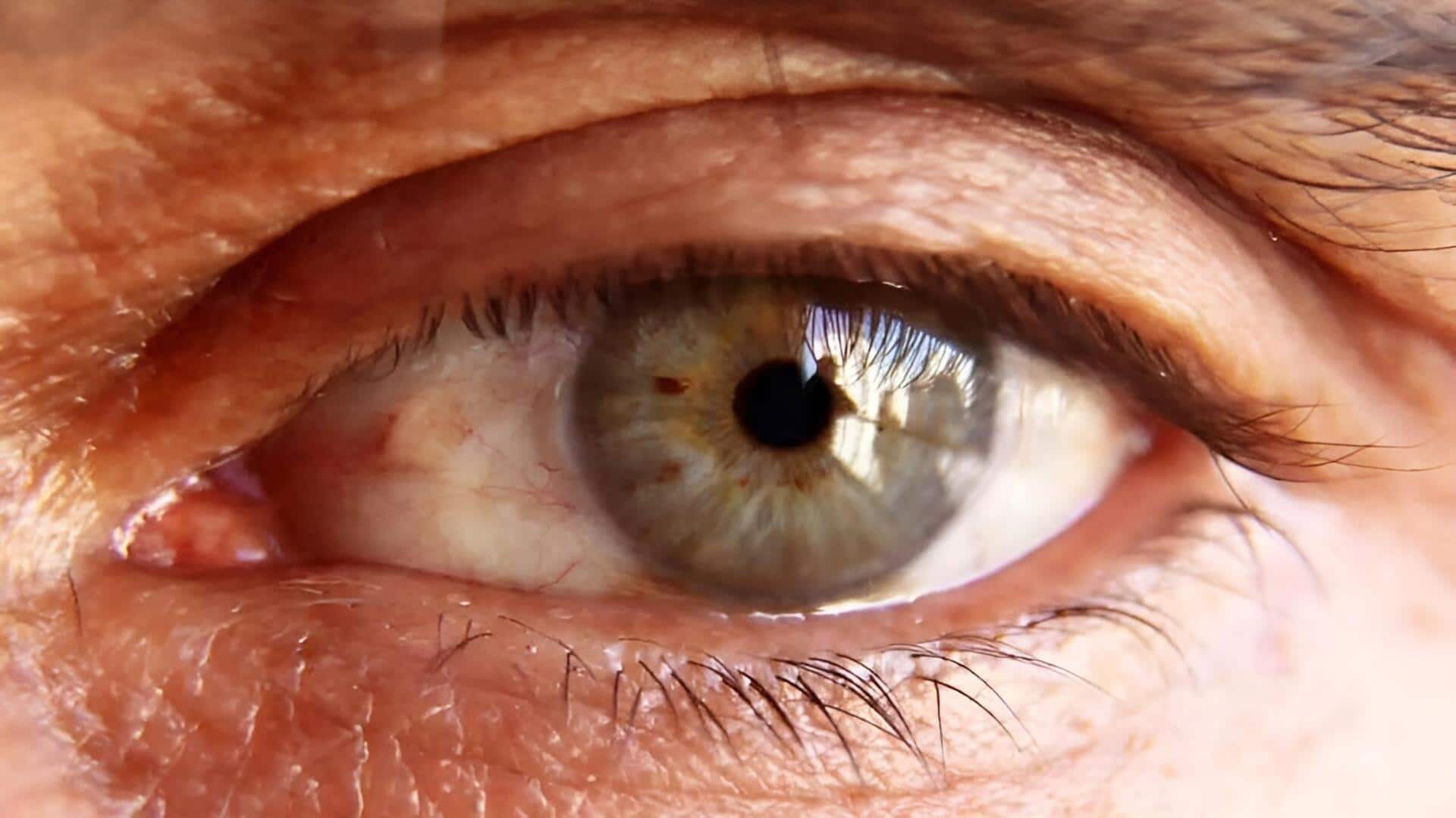 Winter Eye Problems: చలికాలం వచ్చేసింది.. కళ్లపై ప్రత్యేక శ్రద్ధ లేకుంటే ప్రమాదమే!