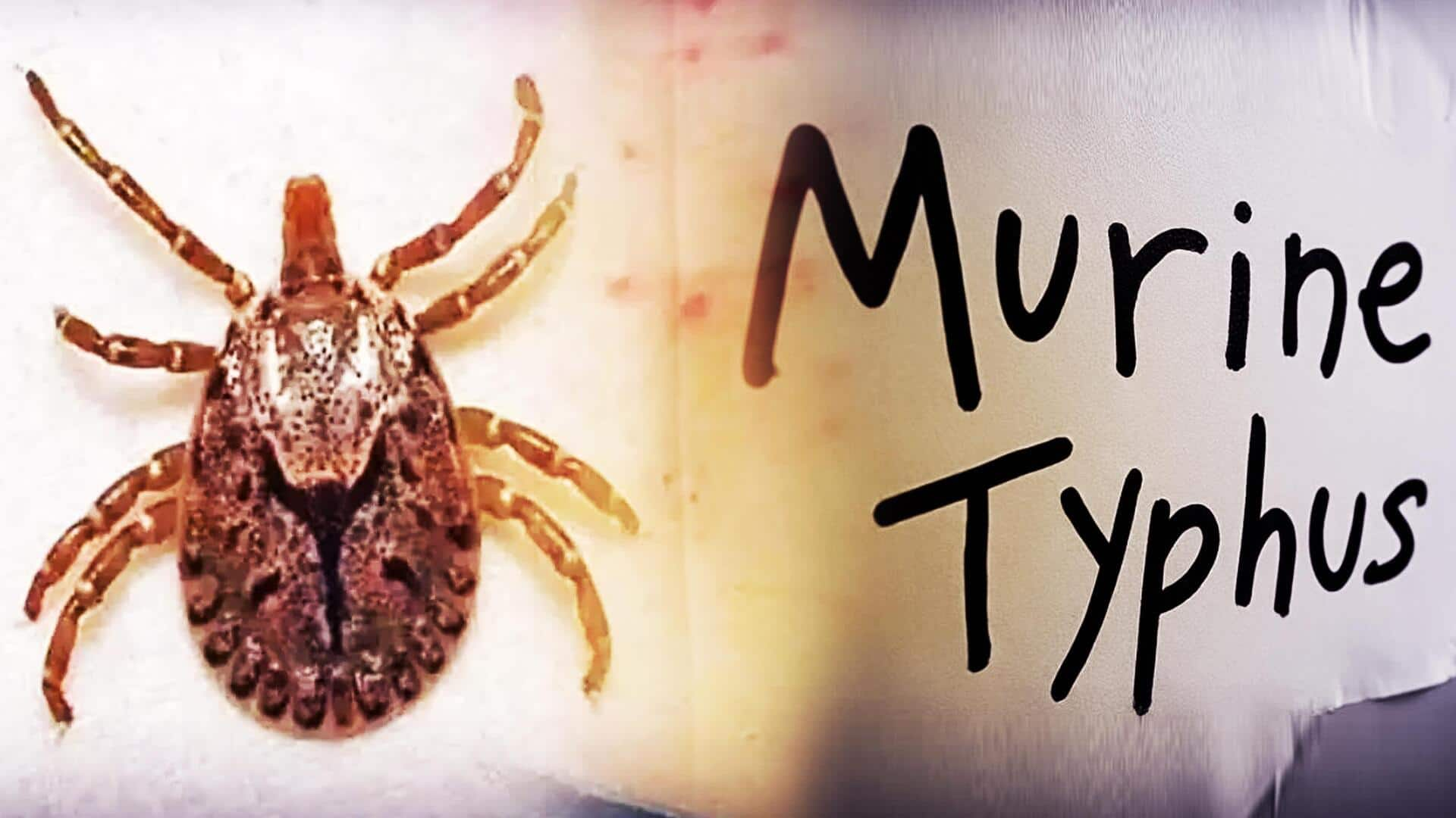 Murine Typhus: కేరళలో మరో అరుదైన వ్యాధి.. మురిన్ టైఫస్‌ లక్షణాలు,చికిత్స, నివారణ  