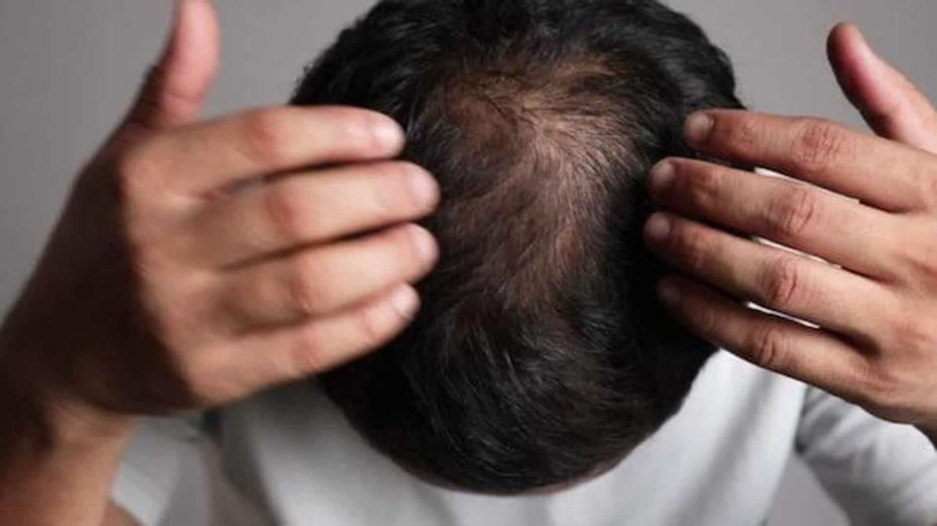 Hair Loss: మహారాష్ట్రలో వారం రోజుల్లోనే బట్టతల.. జుట్టురాలే సమస్యతో బాధపడుతున్న ఆ గ్రామాలు, కారణం అదేనా..?