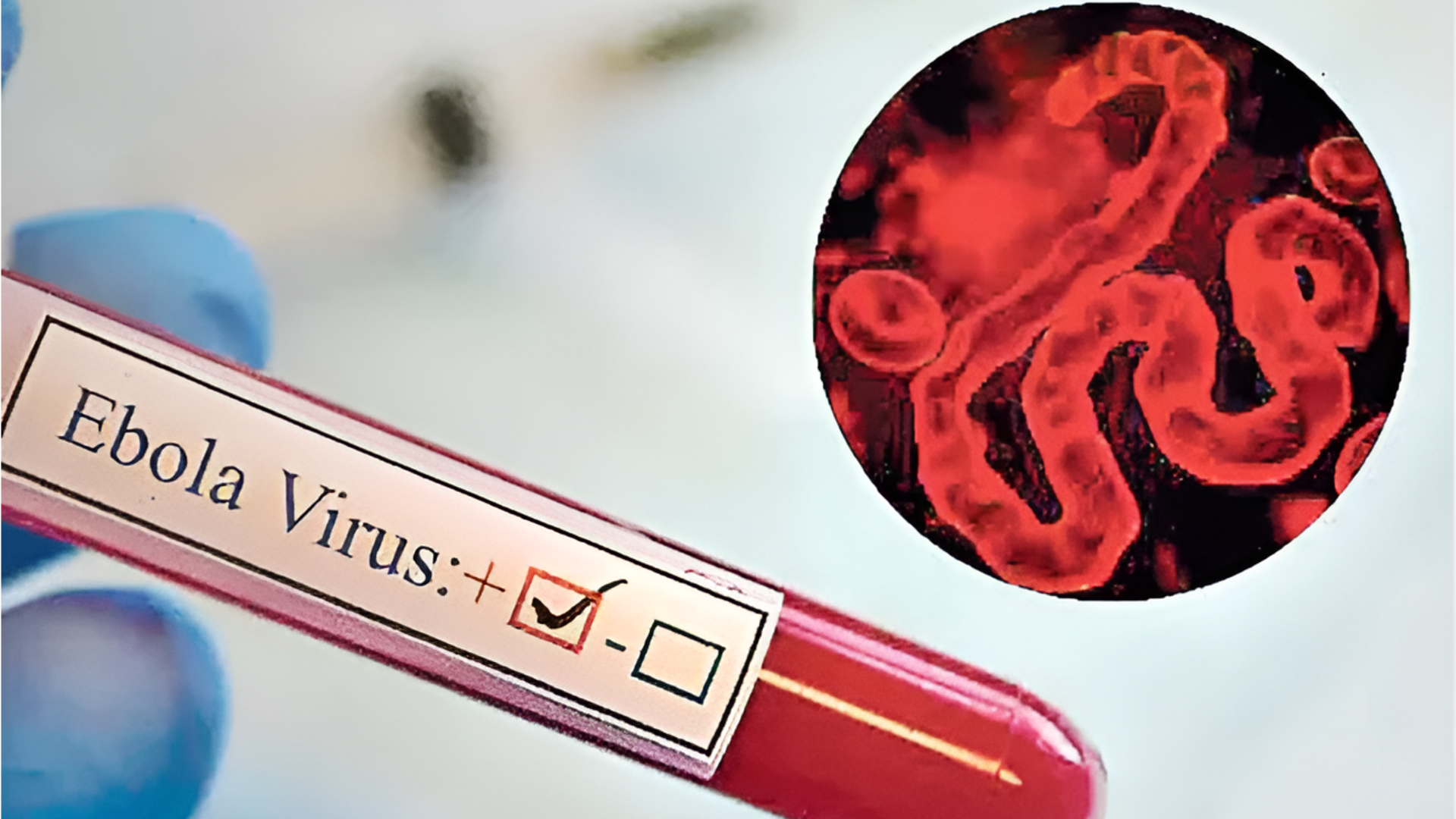 Ebola: ఆరుగురు అమెరికన్లకు ఎబోలా.. ఆఫ్రికాలో వేగంగా విస్తరిస్తోన్న వ్యాధి