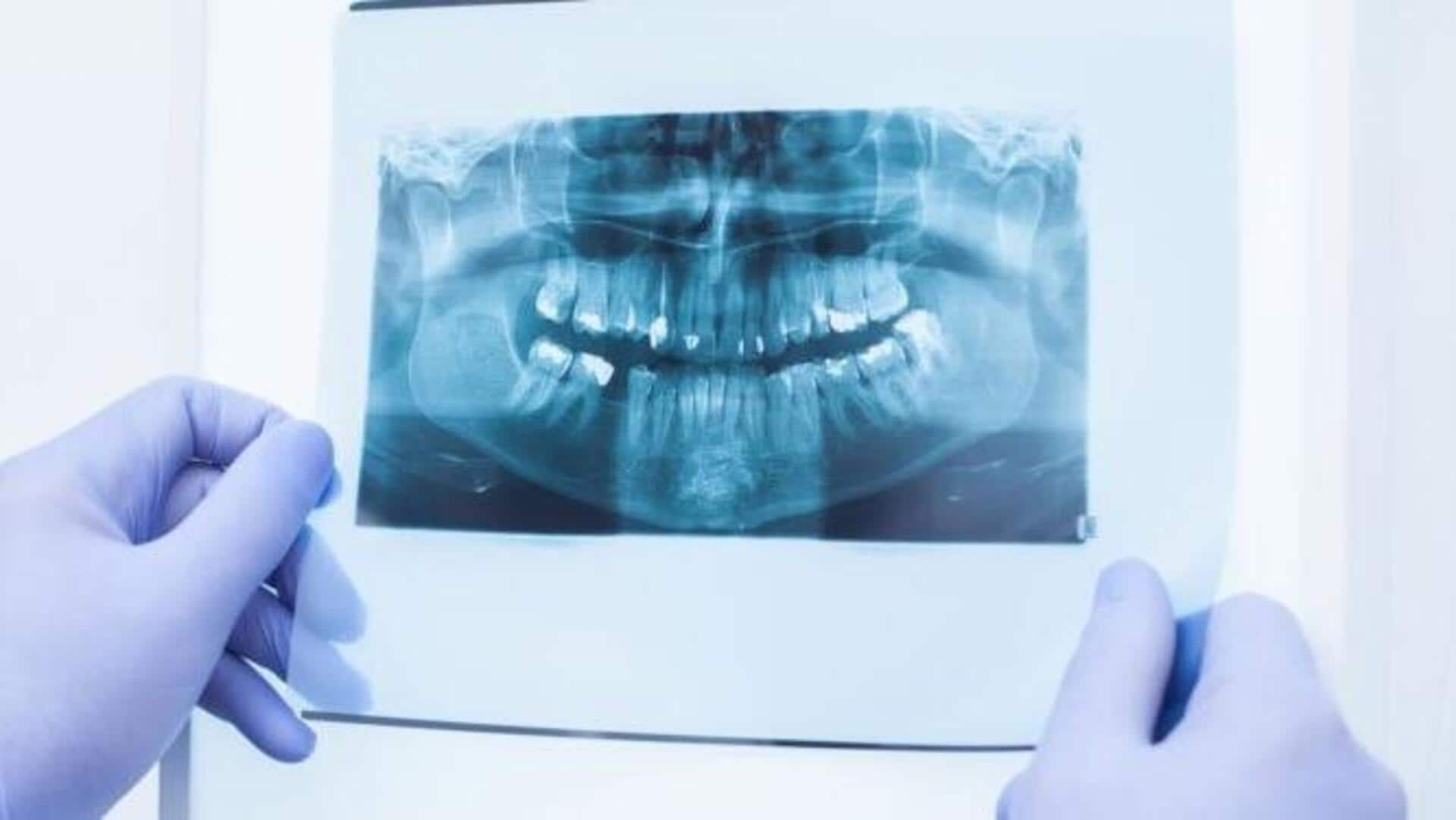 dental X-rays : AI వ్యవస్థ..లింగాన్ని అంచనా వేయడంలో 96% ఖచ్చితత్వం