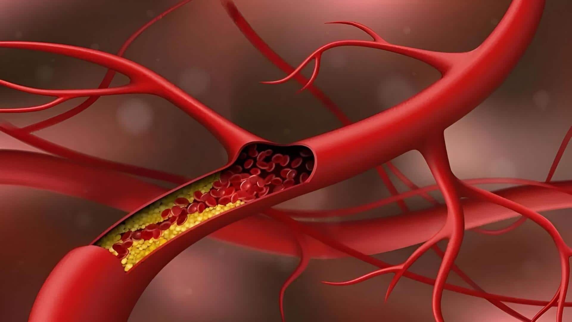 Cholesterol Rise: చలికాలంలో కొలెస్ట్రాల్ పెరుగుతుందా? ఆహారంలో ఈ వస్తువులు తప్పనిసరిగా చేర్చండి!