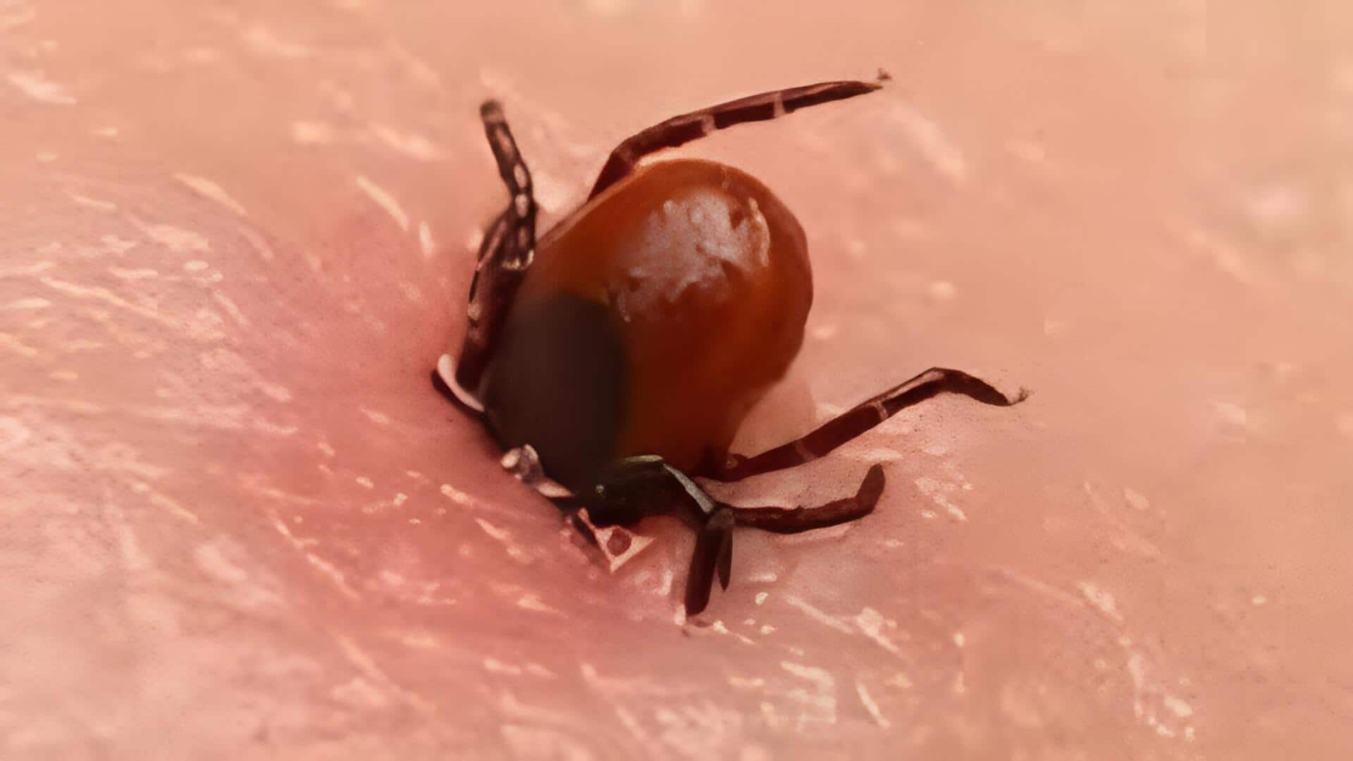 Scrub Typhus: ఏపీలో పెరుగుతున్న 'స్క్రబ్‌ టైఫస్‌' జ్వరాల కేసులు.. చిత్తూరు, కాకినాడ, విశాఖ జిల్లాల్లో అత్యధికం 