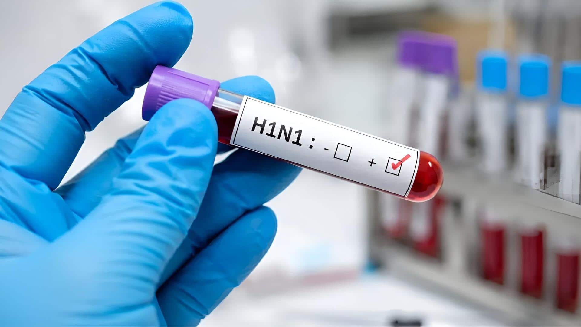H1N1 Cases Rise: ఢిల్లీలో పెరుగుతున్న కేసులు.. లక్షణాలు ఏంటి?ఎవరికి ప్రమాదం ఎక్కువ?