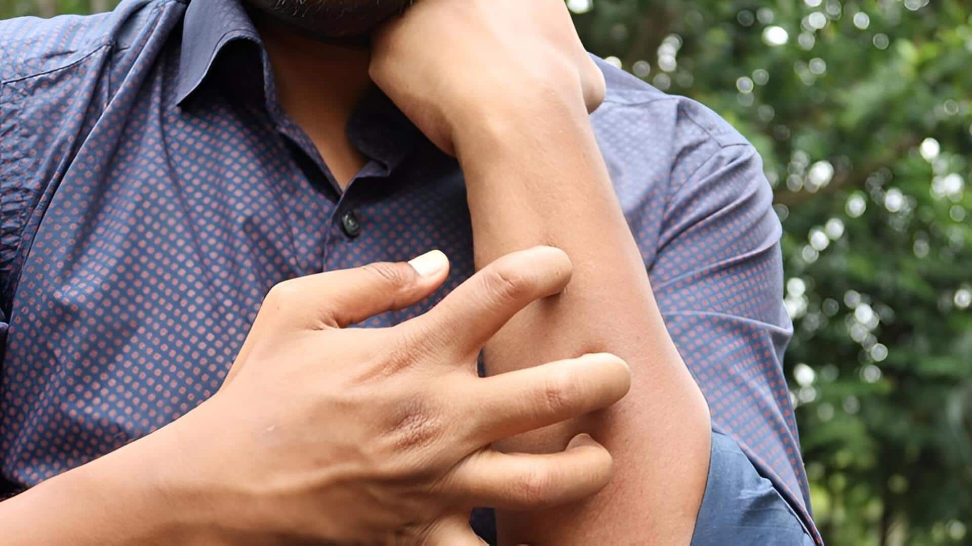 Skin Tips: మాన్‌సూన్‌లో ఈ 5 అలవాట్లు మీ చర్మాన్ని నాశనం చేస్తాయి.. వెంటనే మానేయండి!