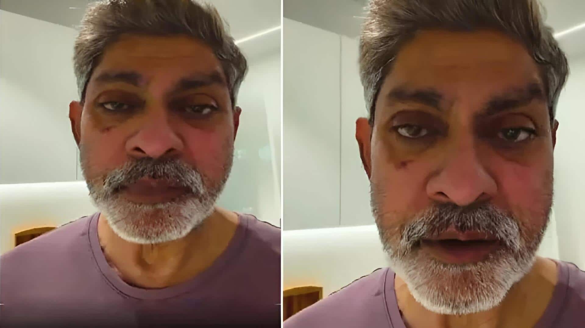 Jagapathi Babu: ముఖంపై గాయాలతో కనిపించిన జగపతిబాబు..అసలు ఏమైందో చెప్పిన నటుడు!