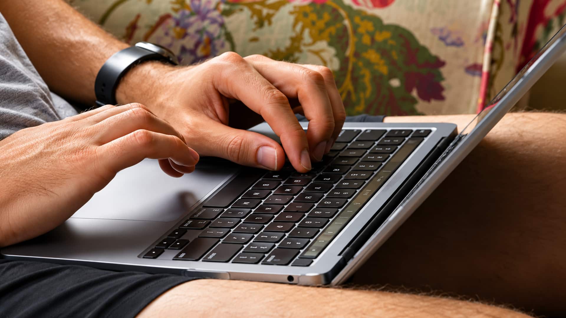 Laptop: ల్యాప్‌టాప్‌ వేడితో చర్మంపై వింత మచ్చలు.. ఇదే 'టోస్టెడ్‌ స్కిన్‌ సిండ్రోమ్‌'